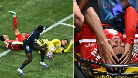 Musiala choc in Psg-Bayern, terribile infortunio dopo lo scontro con Donnarumma. L'esito: "4-5 mesi di stop". Cosa è successo