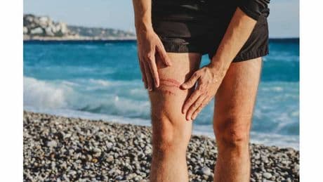 Meduse: cosa fare in caso di puntura?
