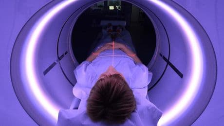 Medizin: CT-Scans können offenbar schon vor einer Schwangerschaft schaden