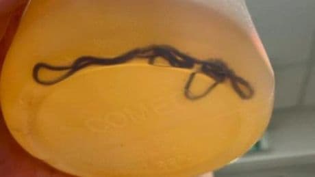 Quand on découvre dans l’urine un « ver »… qui n’en est pas un