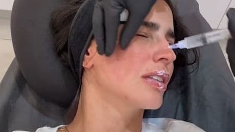 Kim Kardashian hat es vorgemacht - Lachs-Sperma soll schön machen