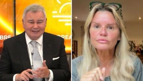 Eamonn Holmes uses vile racial slur as Kerry Katona describes her cosmetic surgery