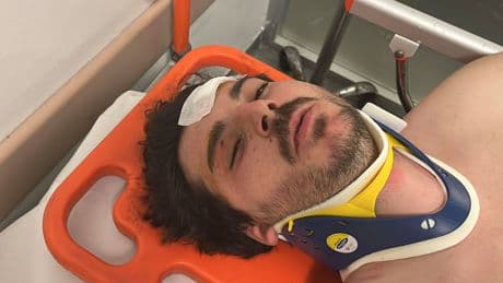 4 kişinin trafikte darbettiği oyuncu: Öldürene kadar döveceklerdi