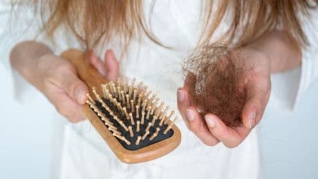 Schönheit um jeden Preis? - Wer so abnimmt, riskiert Haarausfall
