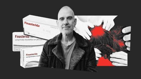Hablan las víctimas de la finasterida, el crecepelo que Europa ha puesto en la diana: "Yo no sé ni cómo me aguanto"