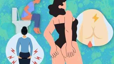 The 6 signs of bum cancer often mistaken for less serious conditions – as experts warn of surging cases
