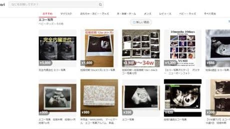 Au Japon, le business juteux et inavouable des photos d’échographies