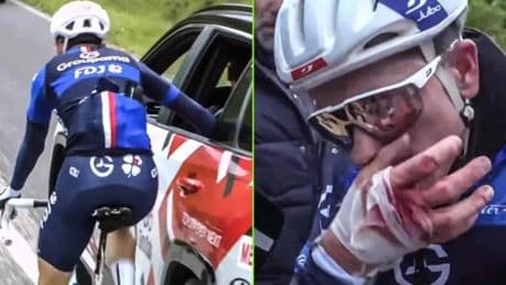 David Gaudu, destrozado en el Giro: “¿Eres tonto? ¡Tengo un agujero en la mano!”