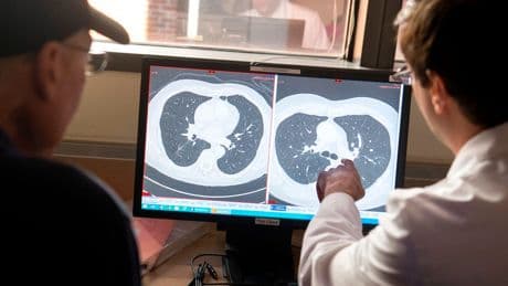 How much you pay in taxes may show how high your cancer risk is. Here’s why