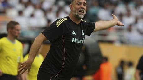 Juve "ja" col Borussia ma è un cantiere aperto