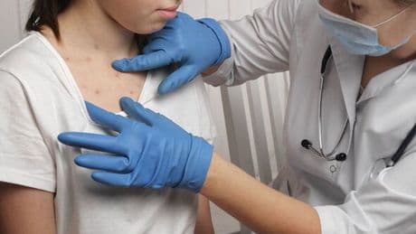 Victorian disease spreading rapidly through Europe as one country has 3,200 cases