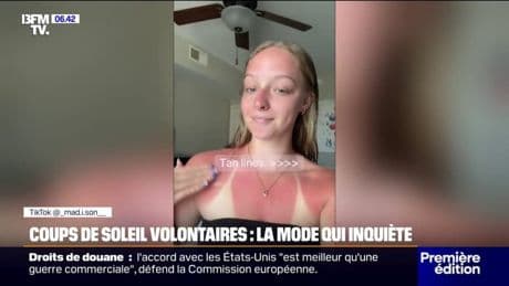 La tendance des "burn lines" inquiète les dermatologues