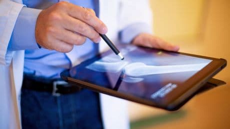 Arthrofibrose: Diagnose und Behandlungsmöglichkeiten