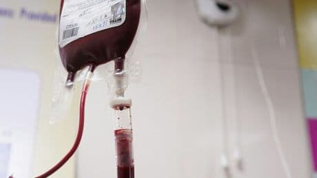 Malattie del sangue, in Italia usata per la prima volta la terapia "Casgevy": svolta nella ricerca