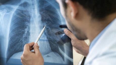Microplastics may be wreaking havoc in your lungs, study finds