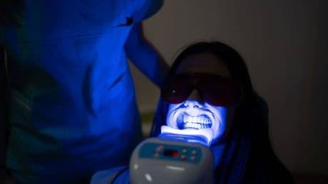 ¿Qué es la blancorexia? Cuando la obsesión por la estética puede llevarte a perder los dientes