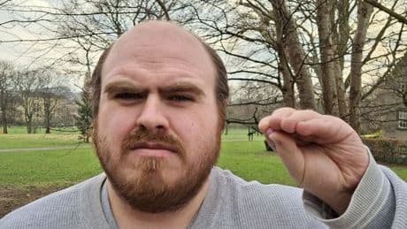 Scot stunned to find Lego brick stuck in ear for 20 years