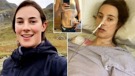 Woman, 39, had 13 organs removed after food poisoning at work party triggered incurable ‘jelly belly’ diagnosis