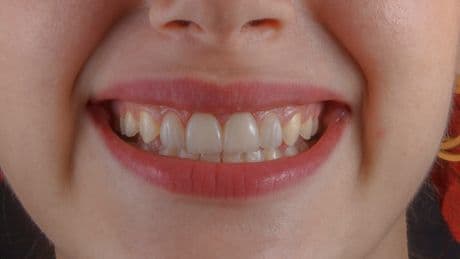 This Gross Addition To Toothpaste Is Actually Best For Natural Enamel Repair