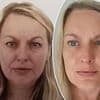 At 44, I realised what alcohol and chain smoking had done to my skin - but now I look like I'm in my 30s again thanks to an amazing 63p trick, says ERICA CROMPTON