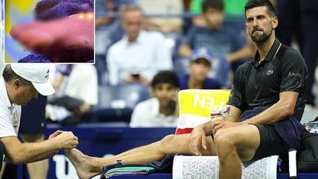 Novak Djokovic's gruesome feet leave fans shocked as he struggles with 'flapping skin' at the US Open to spark concerns over his health