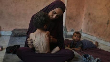 Bande de Gaza : l’Organisation mondiale de la santé alerte sur des « niveaux alarmants » de malnutrition
