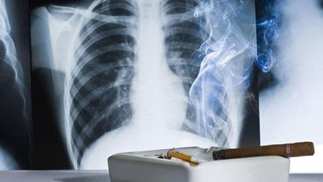 El tabaco y las ministras médicas
