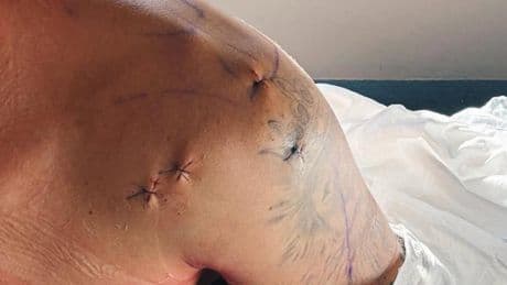 Primer mensaje de Maverick Viñales tras su operación: "Tengo que asegurarme de que vuelvo más fuerte"