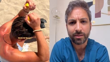 Álvaro Fernández, farmacéutico: “Aplicarse limón en el pelo para aclararlo en verano es peligroso. Si te da el sol después, puedes sufrir una quemadura importante”