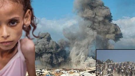 SON DAKİKA HABERLER: GAZZE'DE 1 günde 8 kişi açlıktan, onlarcası yardım ararken öldü! Açlıktan ölmek nasıl bir his?