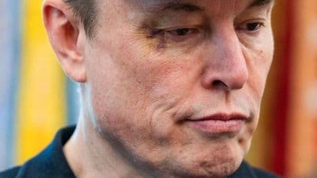 Elon Musk mit blauem Auge: So kam es zu dem Veilchen