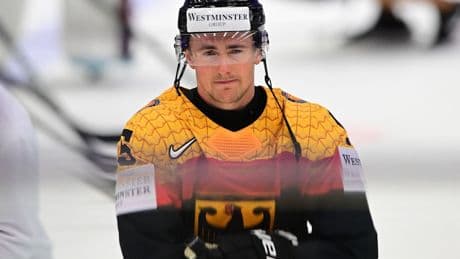 Eishockey-Nationalspieler: Michaelis erleidet Kieferbruch