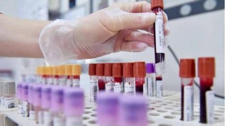 Cancro al seno, oncologi: "Bene test genomici nei nuovi Lea, fare presto"