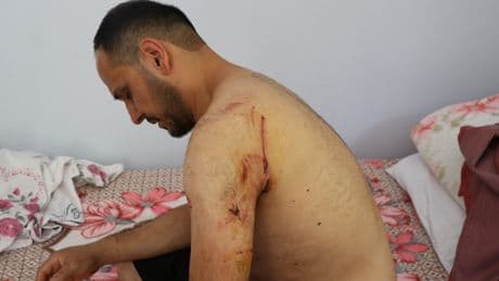 Kayseri'de köpek dehşeti! Karı koca yaralandı