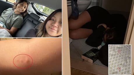 Holidaymaker's dream birthday trip turns into nightmare as hotel room 'BED BUGS' leave her curled up in fear
