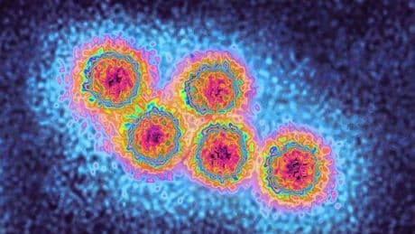 Holiday hotspot loved by Brits issues alert as disease spreads - 'Get vaccinated!'