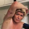 Gewonde Hans Klok negeert adviezen en doet opnieuw gevaarlijke sabelact