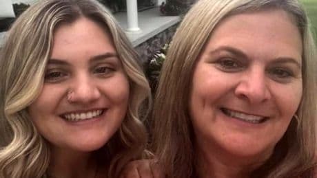 'I got sunburn so badly my own mother didn't recognise me'