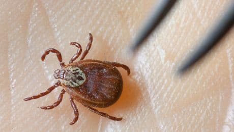Gesundheit: Zahl der Borreliose-Fälle in Sachsen-Anhalt gestiegen
