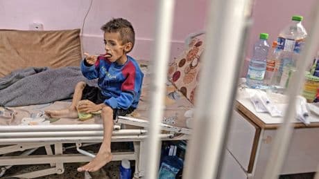 Debatte um Kinder-Fotos: Das Leid in Gaza ist real