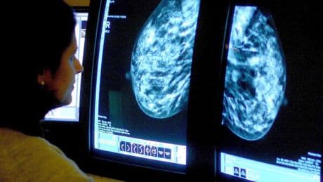 How routine breast screenings could help predict heart problems