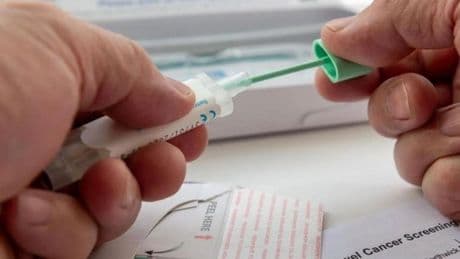 Un estudio vincula la inflamación crónica de las encías con el aumento del riesgo de sufrir cáncer colorrectal