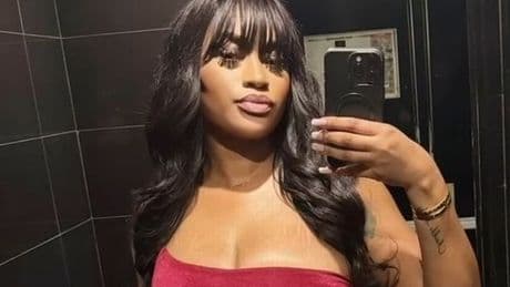 Model dies after undergoing surgery to fix BBL at clinic in Turkey