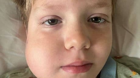 'Our son had a wobbly tooth before aggressive disease diagnosis - listen to your child'