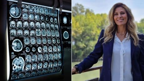 Claudia Adamo, morta di tumore. L'oncologo Perrone: «Lutto che colpisce ma la mortalità tra i giovani si è ridotta di oltre il 20% in 15 anni»