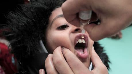 Los expertos alertan de que el sarampión, la rubeola y la polio podrían volver a EEUU: "Estamos al borde del desastre"