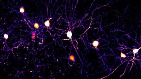Des chercheurs démontrent la complexité des neurones humains grâce à des découvertes inédites