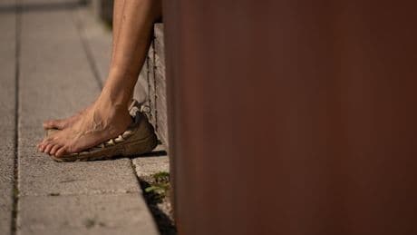 Are ‘Ozempic feet’ real? Here’s what to know