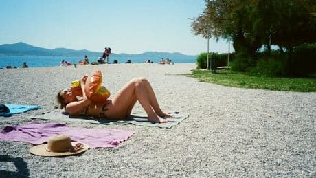 Melanoma, bastano 5 scottature a 15 anni per aumentare il rischio dell'80%. Gli errori da non fare secondo l'esperto