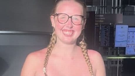 Women photograph tans before and after Spain holiday and people are concerned